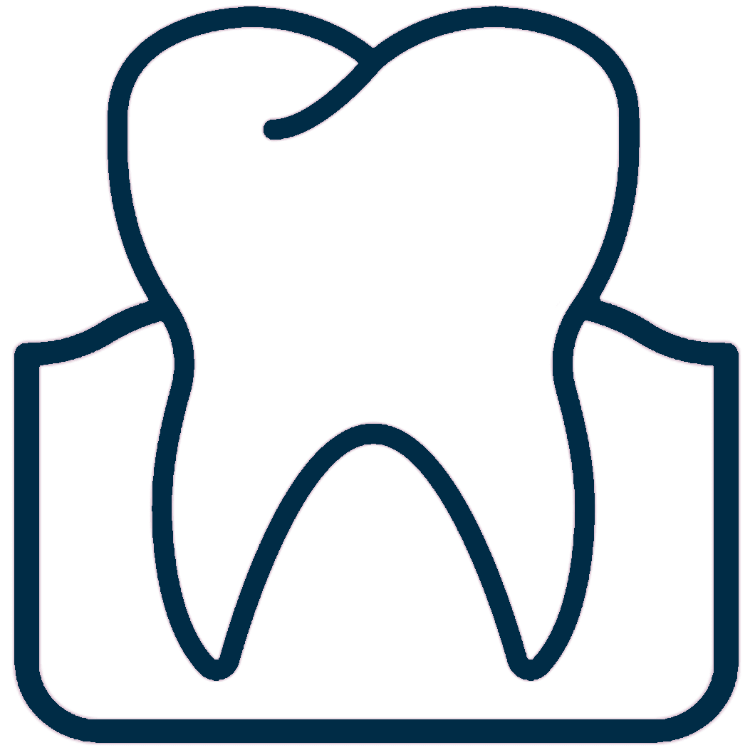 zygomatic implants