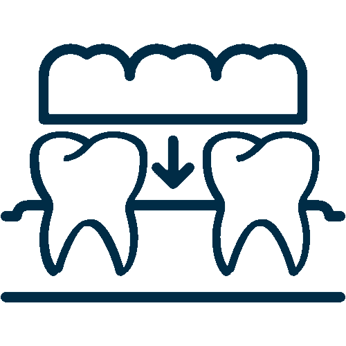 Dental Implant Bridge Dental Implant Bridge