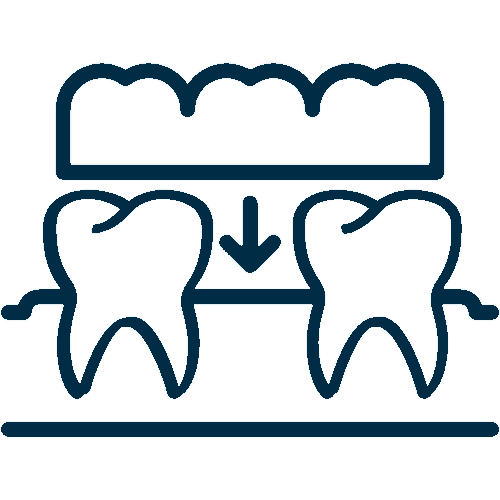 Dental Implant Bridge