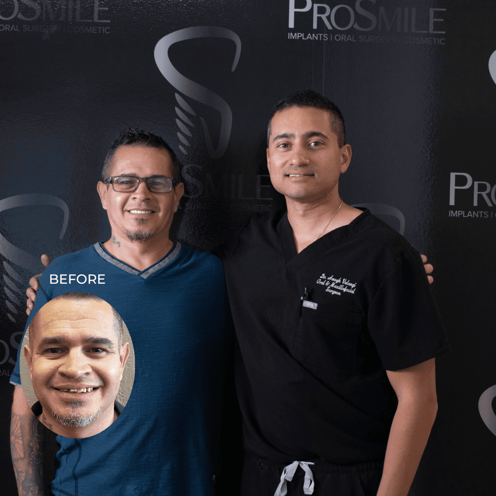 Best Dental Implant Experience in Scottsdale Best Dental Implant Experience in Scottsdale