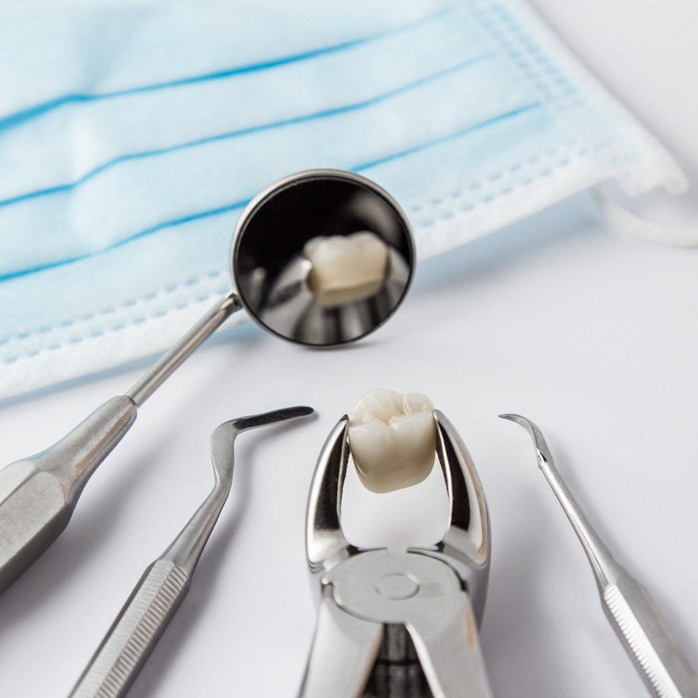 Dental Extractions in Scottsdale AZ