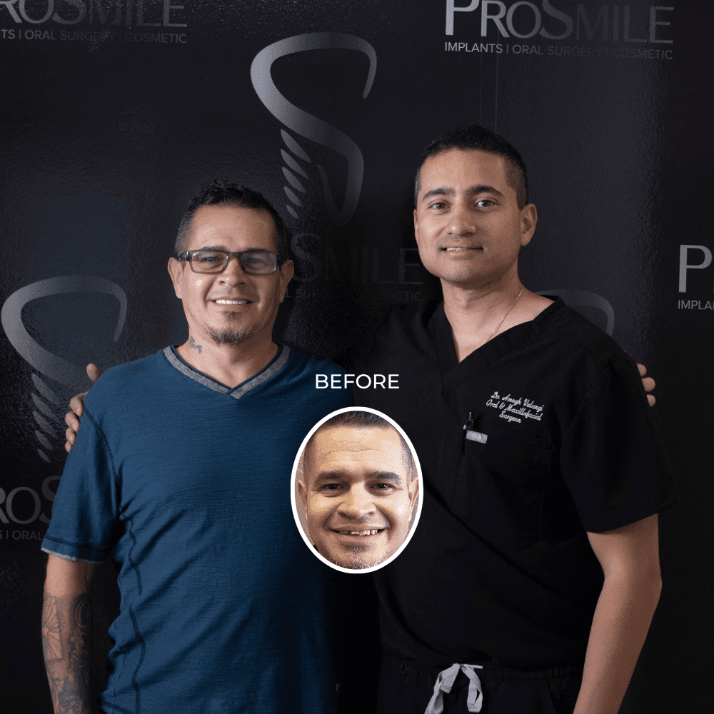 Best Dental Implant Experience in Scottsdale AZ Best Dental Implant Experience in Scottsdale AZ
