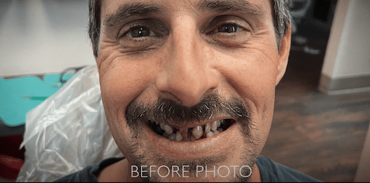 smile-gallery-jesse-2