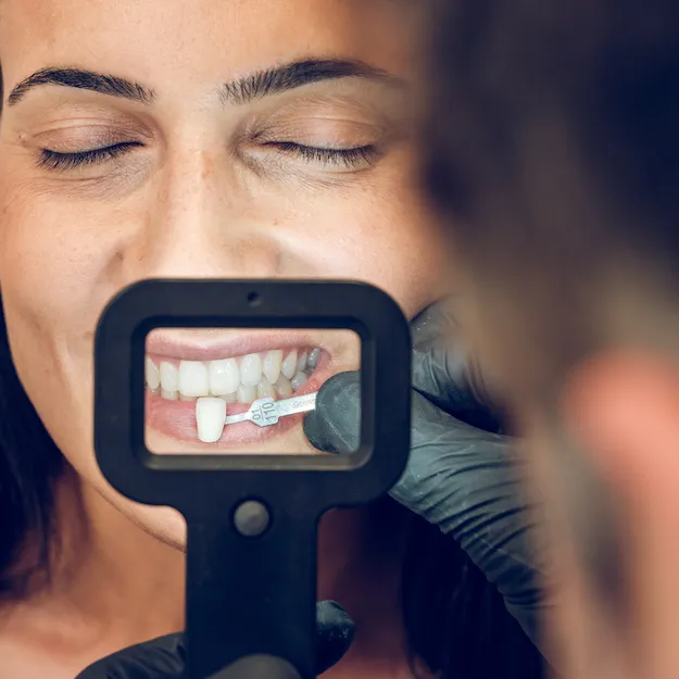 ProSmile-site-photos-53