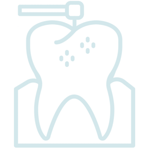 Root-Canals
